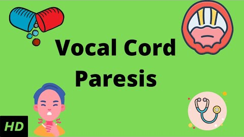 Vocal Cord Paresis, Causes, Signs and Symptoms, Diagnosis andTreatment.