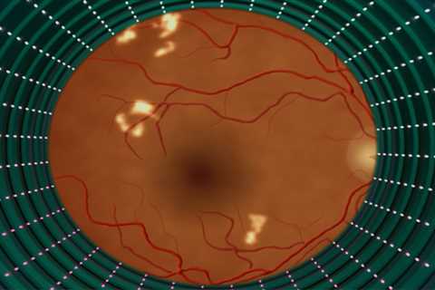 Programas de inteligencia artificial diagnostican retinopatía diabética en minutos