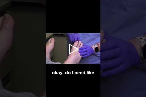 Is Your Long Toe Causing Nail Problems #ToeLength #NailIssues #FootHealth