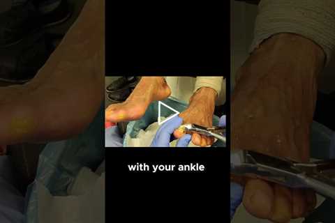 Nail Care Removing the Unattached Parts