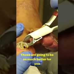 Trimming Time: A Talk on Nail Health 💅✨