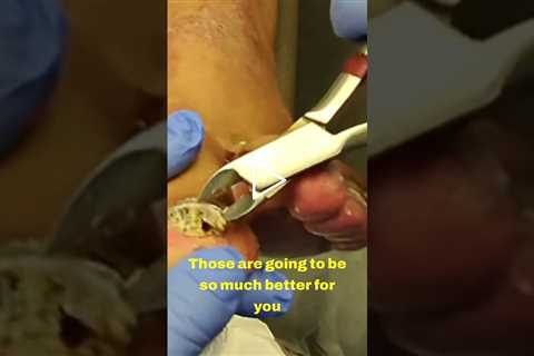Trimming Time: A Talk on Nail Health 💅✨