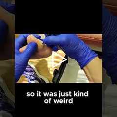 The Mystery of the Farmer Who Didn't Want His Cows Photographed!  #drnailnipper #foothealth