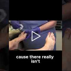 Why People Hide Their Feet and How to Feel Comfortable Again! #FeetConfidence  #MentalHealth