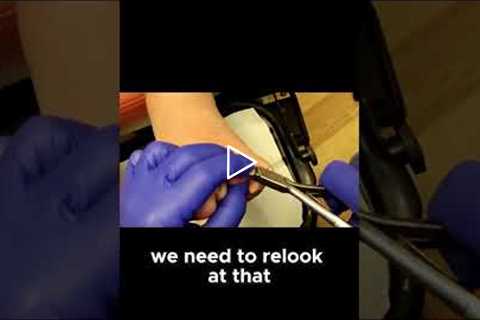 How Regular Nail Trims Can Prevent Painful