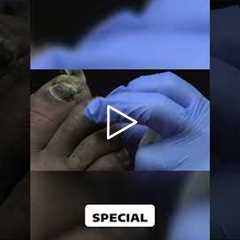 Choosing the Right Footwear for Diabetes Management