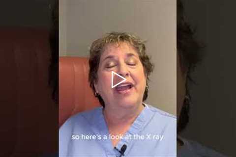 J's Infected Ingrown Nail - Intro