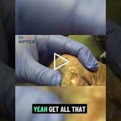 Whose Feet Are These? 😲 Immediate Relief for Throbbing Calluses