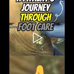 A Patient's Journey Through Foot Care 🦶 #footcare  #PatientsJourney #ShrekFeet #FootProblems #ouch