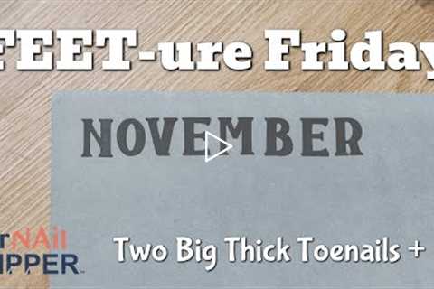 FEET-ure Friday | Two Big Thick Toenails +  #thicktoenails