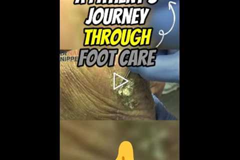 A Patient's Journey Through Foot Care 🦶 #footcare  #PatientsJourney #ShrekFeet #FootProblems #ouch