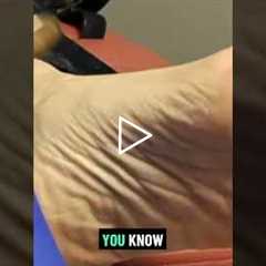 Exploring Callus Management Techniques | Callus Plugs: Why They Hurt So Much! 🦶😖