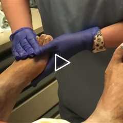 Why Nail Fungus Treatments Fail — Plus Real Talk About Consistency & Care