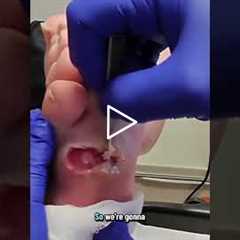 The Doctor’s Plan for Ongoing Wound Care 🩹