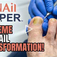 How Often Should You See a Podiatrist? (2.5-Month Foot Care Visit)