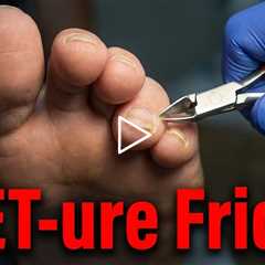 FEET-ure Friday | Loose Toenail? Safe Trim + Important Skin Check Reminder