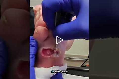 The Doctor’s Plan for Ongoing Wound Care 🩹