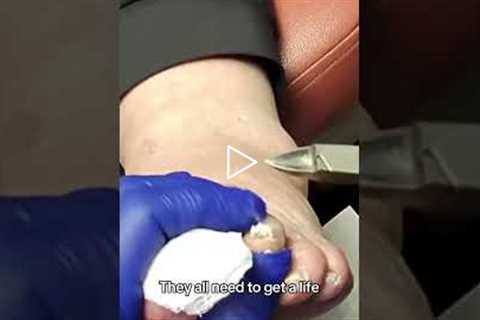 The Pros and Cons of Light Therapy for Neuropathy