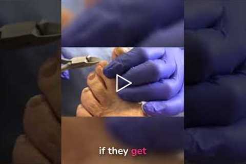 Fungal Infection Myths BUSTED! It's NOT Systemic