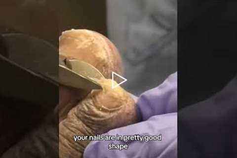 “When I Trimmed Them… They Were WAY Bigger!” 👀 The Benefits of Pedicures