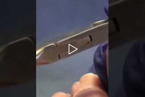 The Painful Callus A Foot Doctor's Perspective | Painful Callus Relief in Minutes 👣