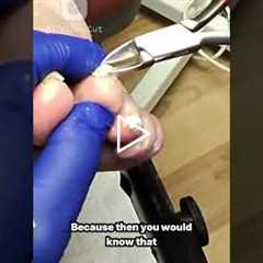 When “Thank You” Doesn’t Make Sense 🤦‍♂️ | Podiatry Office Talk