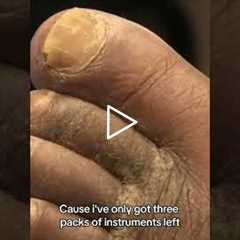 A Foot Doctor's Experience | Behind the Scenes of a Busy Foot Care Clinic