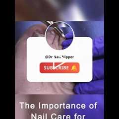 The Importance of Nail Care for Diabetics 💅