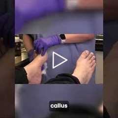 Satisfying Nail Smoothing ✨ | Routine Foot Care That Feels Amazing