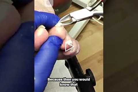 When “Thank You” Doesn’t Make Sense 🤦‍♂️ | Podiatry Office Talk