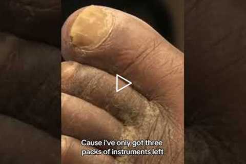 A Foot Doctor's Experience | Behind the Scenes of a Busy Foot Care Clinic