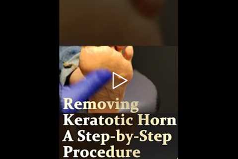 Removing Keratotic Horn A Step-by-Step Procedure