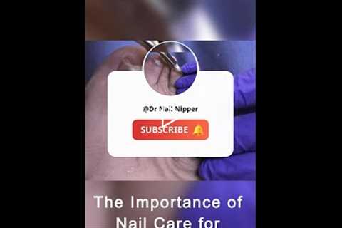 The Importance of Nail Care for Diabetics 💅