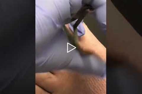 The Most Satisfying Foot Cleaning You've Seen