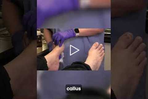 Satisfying Nail Smoothing ✨ | Routine Foot Care That Feels Amazing