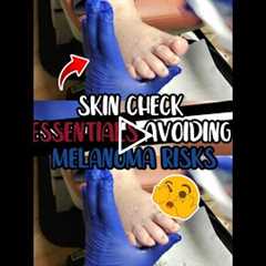 Skin Check Essentials Avoiding Melanoma Risks