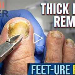 FEET-ure Friday | Gentleman with Long, Thick Toenails