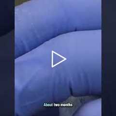 This Toenail Has Been Growing for a YEAR! Unbelievable!