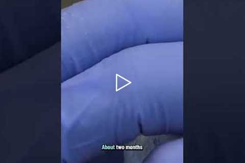 This Toenail Has Been Growing for a YEAR! Unbelievable!