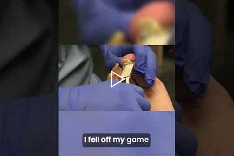 The Big Toe Dilemma A Carnie's Journey #podiatry #drnailnipper #satisfying #footcare