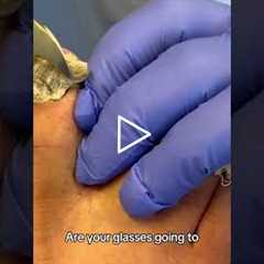 😲 HUGE Callus Chunk Removed! We Like Big Chunks | Dr Nail Nipper