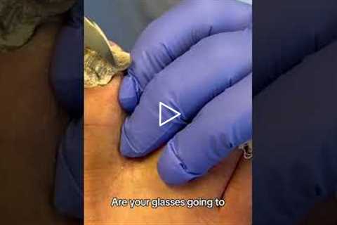 😲 HUGE Callus Chunk Removed! We Like Big Chunks | Dr Nail Nipper