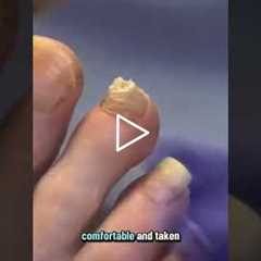 If you can reach your foot and see, it's fine, but always have antibiotic ointment