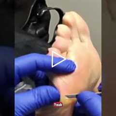 Will it ever go away: A skin problem or a pressure problem