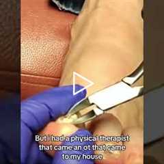 Nobody Warns You About Stroke Recovery 😢🧠